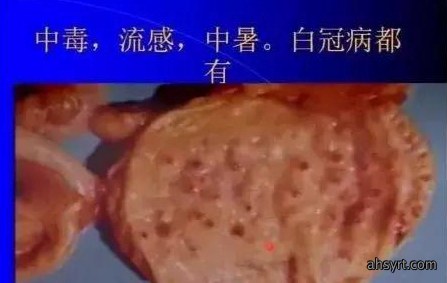 解剖诊断鸡病，三个器官很重要